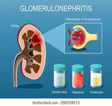 PROTEINURIA: FROM THE PAST TO THE CURRENT METHODS OF ANALYSIS