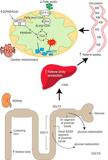 Ketones in Focus: From Metabolism to Crisis