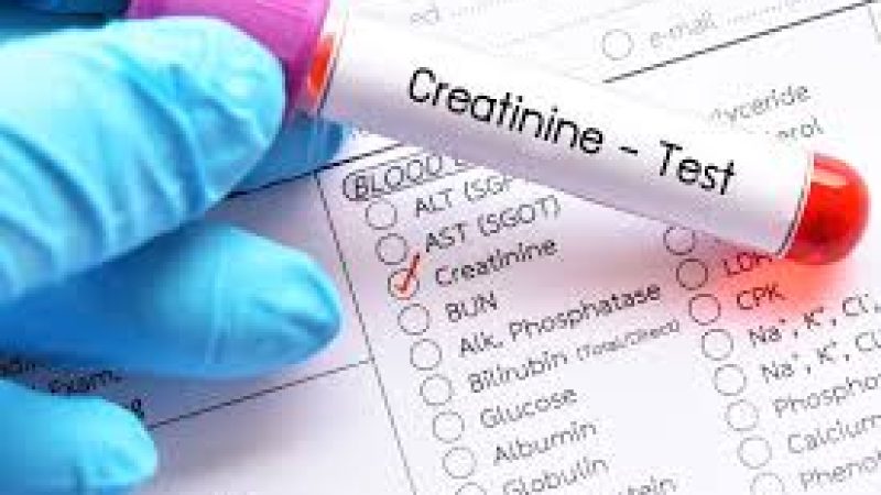 creatinine